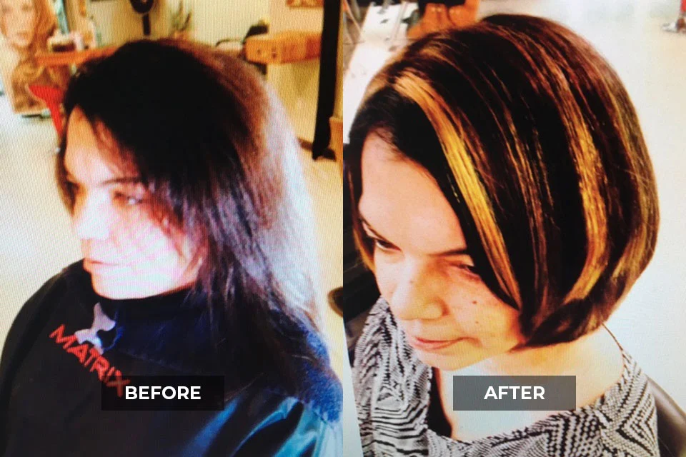 before-after9